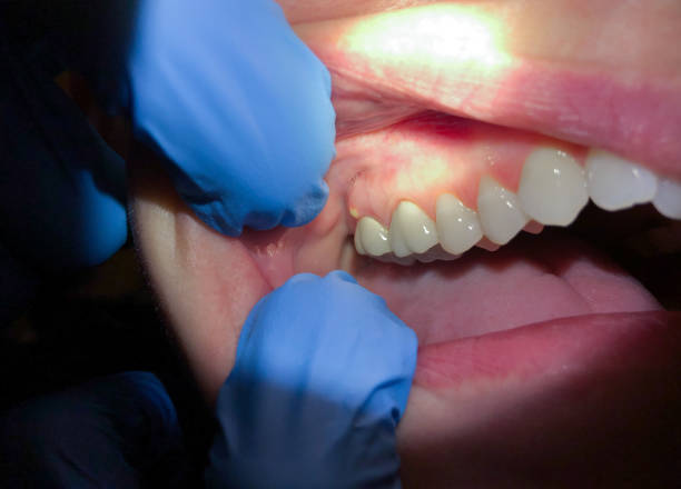 Best Weekend Emergency Dentist in Flower Mound, TX