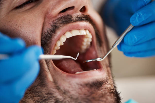 Best Emergency Broken Tooth Repair in Flower Mound, TX